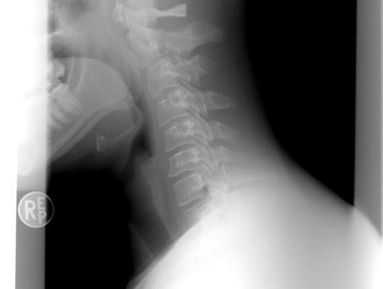 Jak wygląda rezonans magnetyczny kręgosłupa i kiedy jest zalecane badanie?