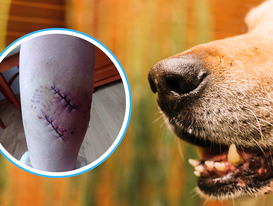 Spokojny spacer zmienił się w dramat. Atak psów w Otmicach Spokojny spacer zmienił się w dramat. Atak psów w Otmicach