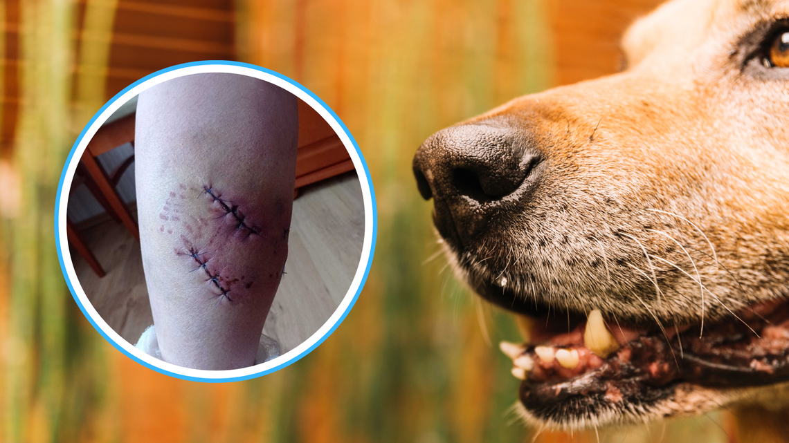 Spokojny spacer zmienił się w dramat. Atak psów w Otmicach